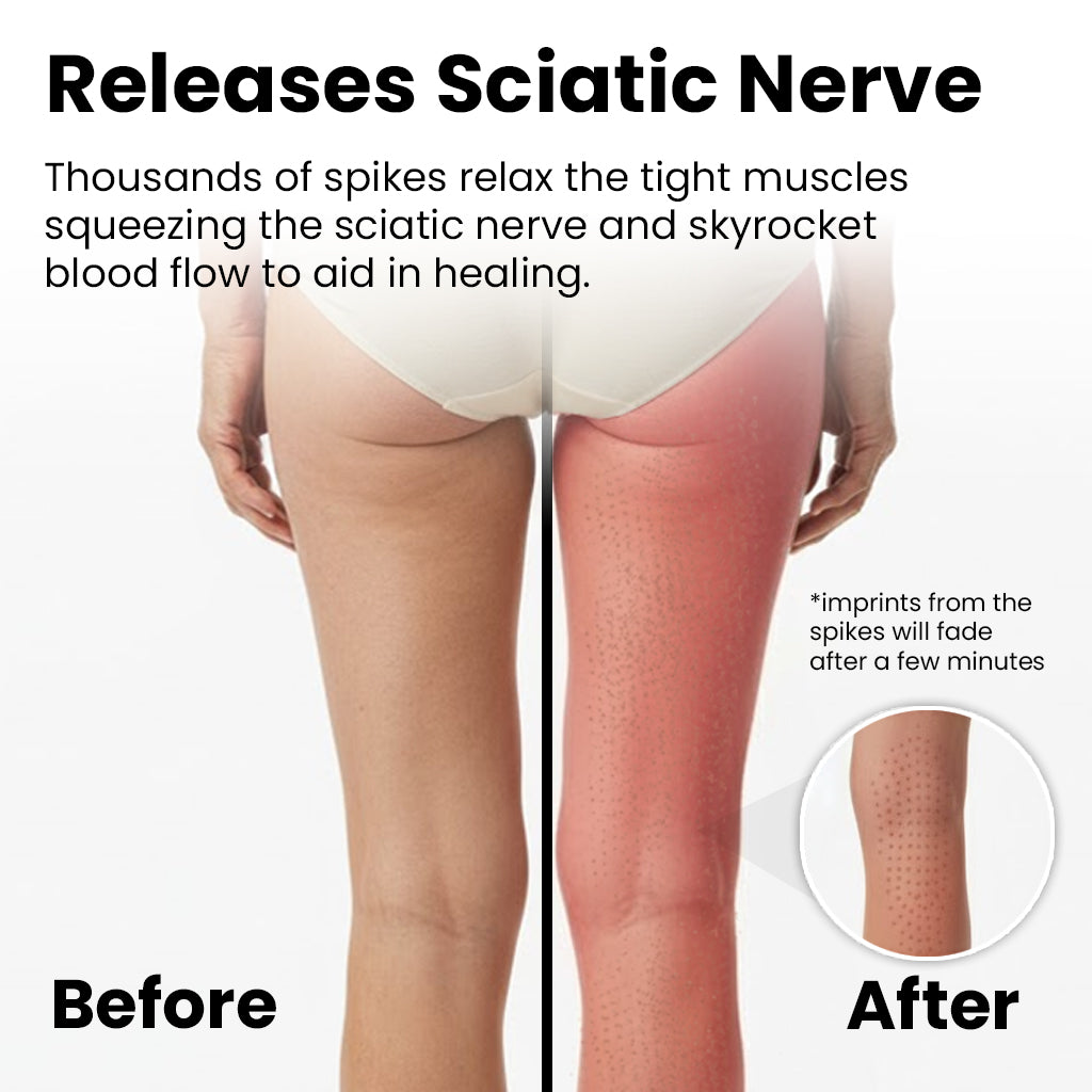 KenRelief Acupressure Set